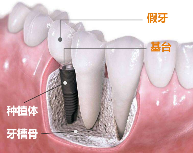 1-1Z52Q602001Y.jpg