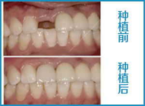 1-1504291H910410.jpg