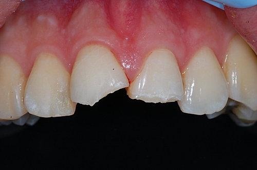 09513V5U-1.jpg